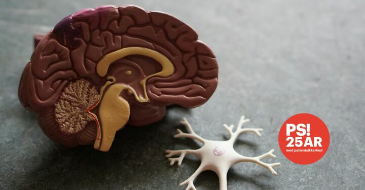 Model af halvdelen af en menneskehjerne samt PS! 25 års jubilæums logo indsat